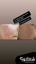 Amal Skin Care