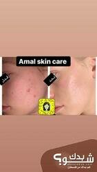 Amal Skin Care