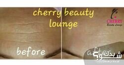 مركز تجميل شيري بيوتي Cherry beauty lounge | خبيرة البشره شيرين سالم‏