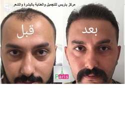 مركز باريس للتجميل والعناية بالبشرة