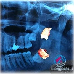 عيادات النسيم لطب وزراعة الاسنان