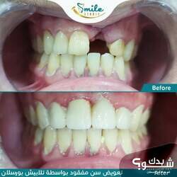 Smile Studio Dental Clinic الدكتورة شذى الهندي و الدكتور مراد أبو عصب