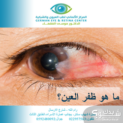 المركز الالماني لطب العيون و الشبكية German Eye & Retina Center