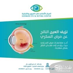 المركز الالماني لطب العيون و الشبكية German Eye & Retina Center