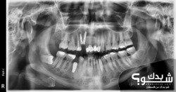 العيادة الروسية لطب وزراعة الاسنان