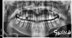 العيادة الروسية لطب وزراعة الاسنان