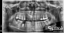 العيادة الروسية لطب وزراعة الاسنان