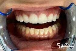 Prodental clinic عيادات الدكتور مهند الخضور 